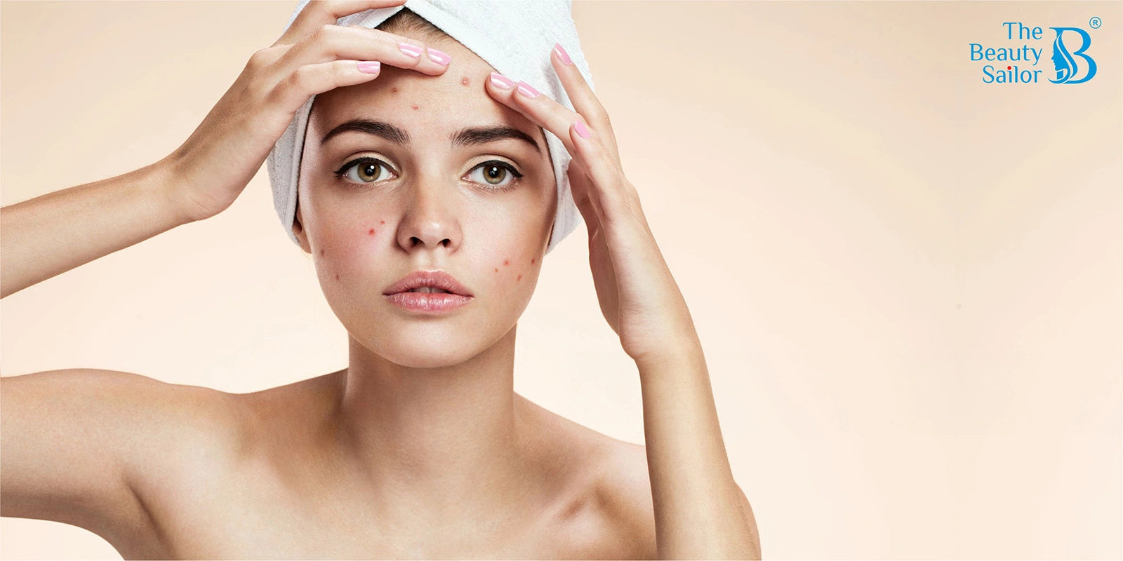 Effective Acne Control: How Niacinamide Can Help