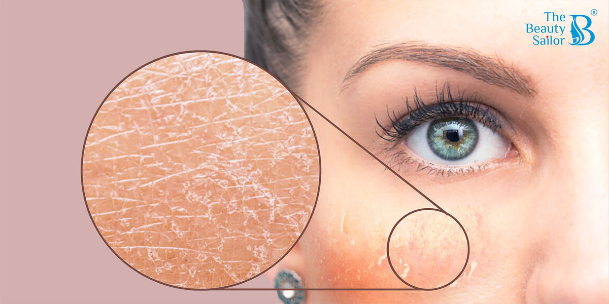 Prevent Skin Purging: Dos & Don'ts Guide:The Beauty Sailor