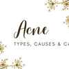 Acne: Types, Causes & Care